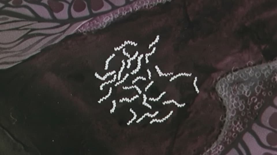 Venereal disease (syphilis and gonorrhea) Stock Footage.