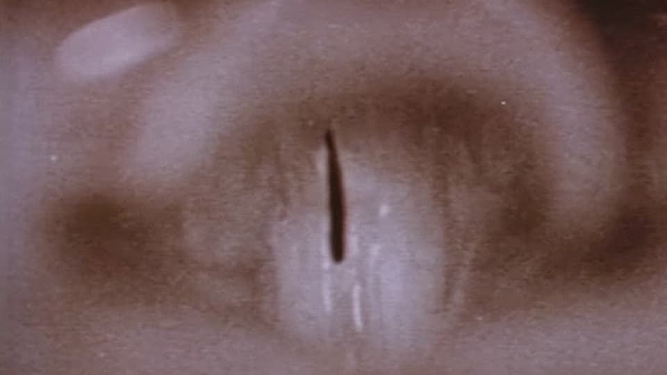 Vocal Cords stock footage thumbnail